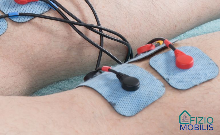 Elektrostimulacija u terapiji mišića